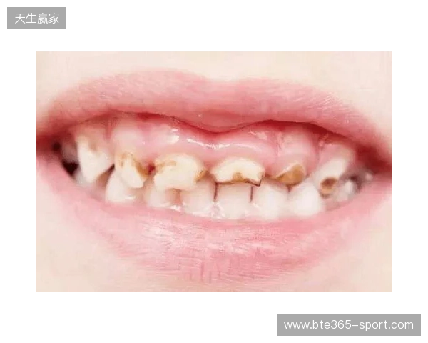 韦林顿确诊上唇部贯通伤；11、21牙半脱位；上颌前牙区牙槽骨骨折