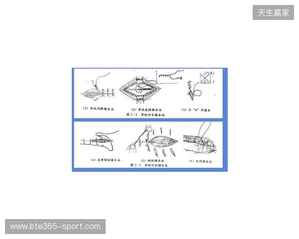 广州豹官方：杨浩眉弓伤口缝合30余针，预计5-7天后拆线